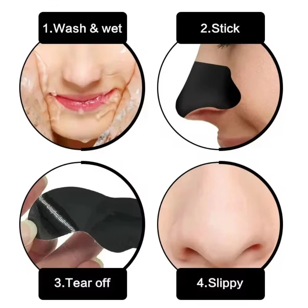 Blackhead Removal Stickers (10/50/100PC) – Deep Cleansing Nose Pore Strips
