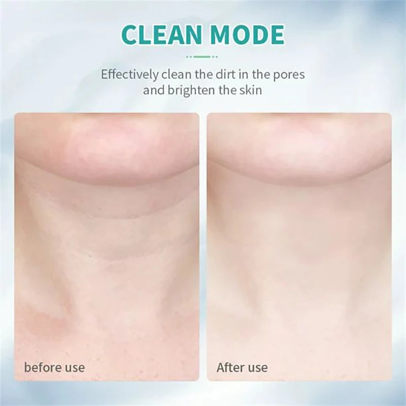 Neck & Face Slimming Massager – Lifting & Wrinkle Reduction Beauty Device