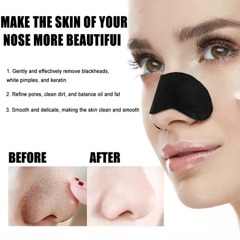 Blackhead Removal Stickers (10/50/100PC) – Deep Cleansing Nose Pore Strips