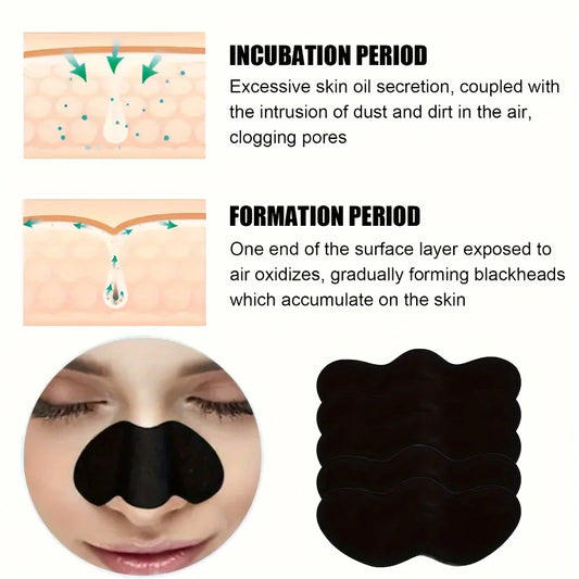 Blackhead Removal Stickers (10/50/100PC) – Deep Cleansing Nose Pore Strips