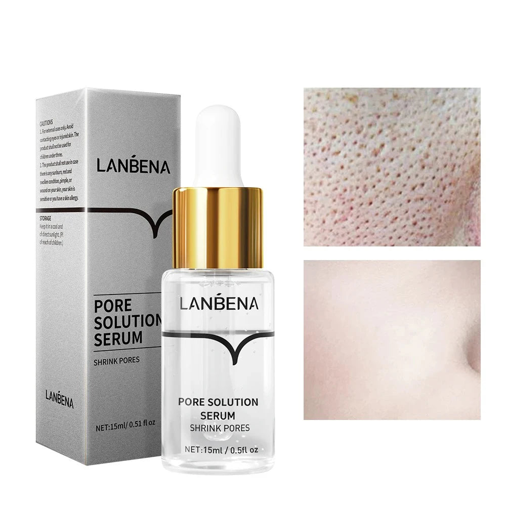 LANBENA Nose Botanical Pore Strip – Deep Cleansing Blackhead Treatment & Pore Refining Serum 30g - Lylamor.com