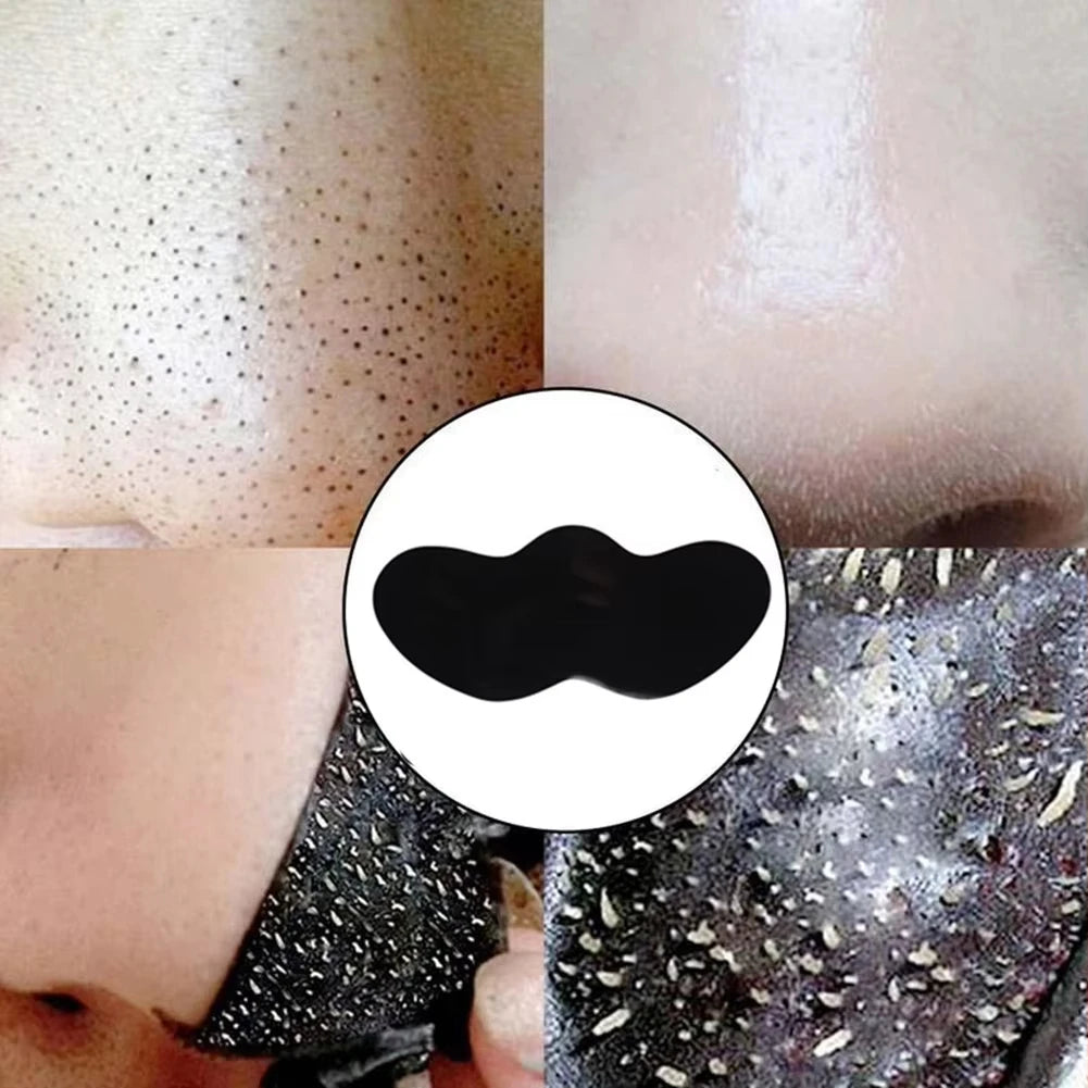 Blackhead Removal Stickers (10/50/100PC) – Deep Cleansing Nose Pore Strips