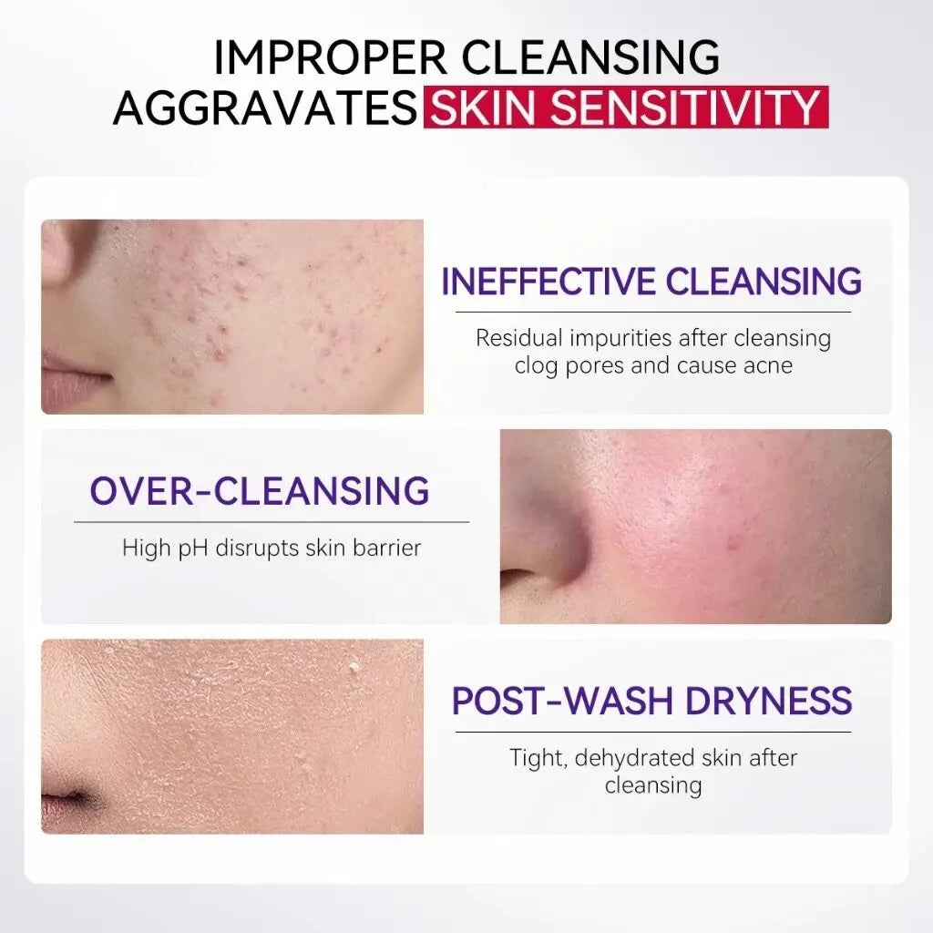 LANBENA Retinol Facial Cleanser – Oil Control, Hydrating Amino Acid Foam Anti-Aging Face Wash 100g - Lylamor.com