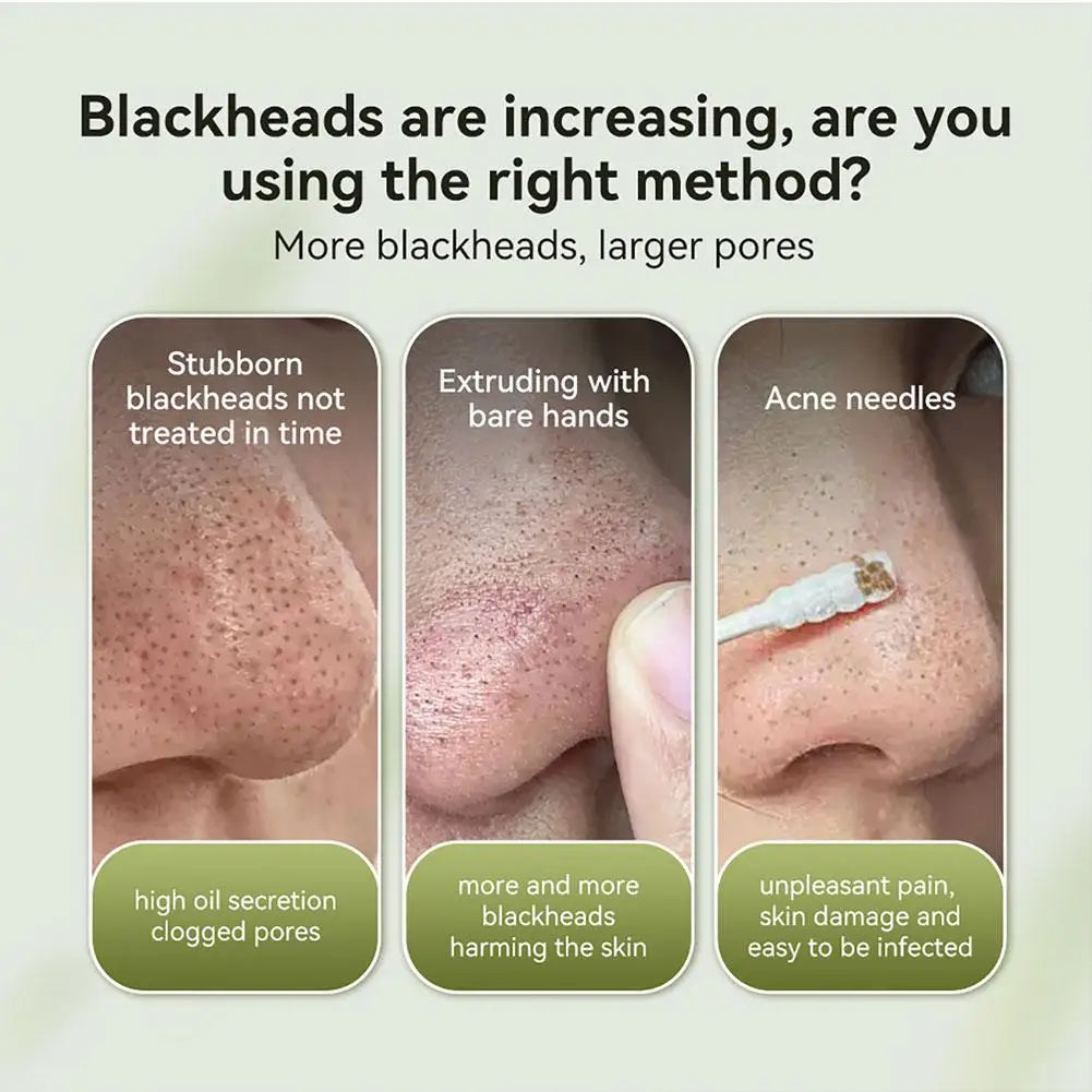 LANBENA Blackhead Remover Peel Off Mask with 2% BHA – Nose & Face Pore Strips - Lylamor.com