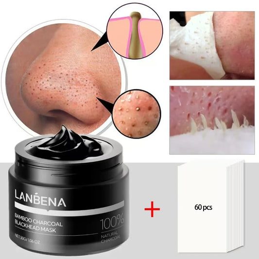 LANBENA Charcoal Blackhead Remover Nose Strips – Deep Cleansing Pore Care 30g - Lylamor.com
