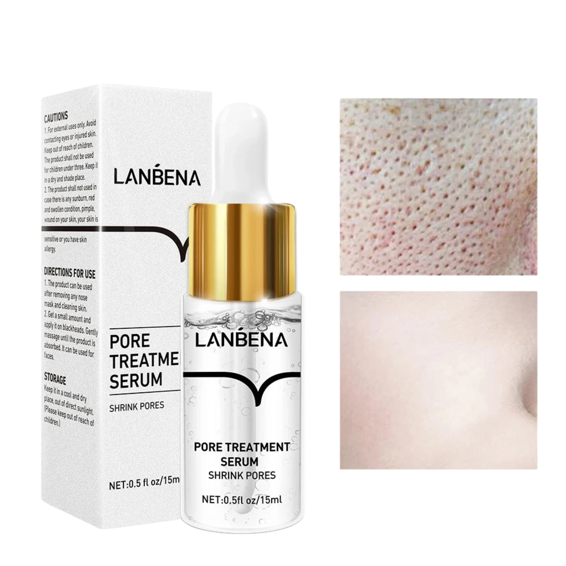 LANBENA Pore Minimizing Facial Serum – Blackhead Removal & Pore Tightening, 30ml - Lylamor.com