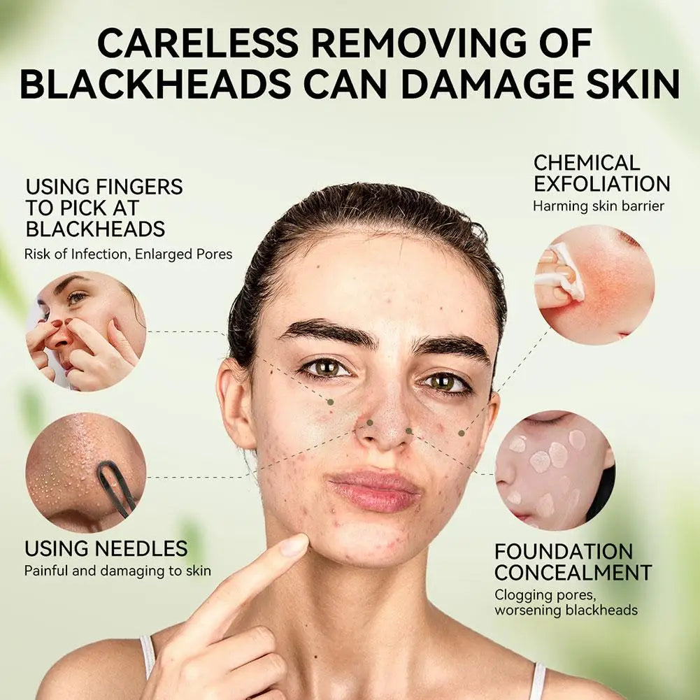 LANBENA Blackhead Remover Peel Off Mask with 2% BHA – Nose & Face Pore Strips - Lylamor.com