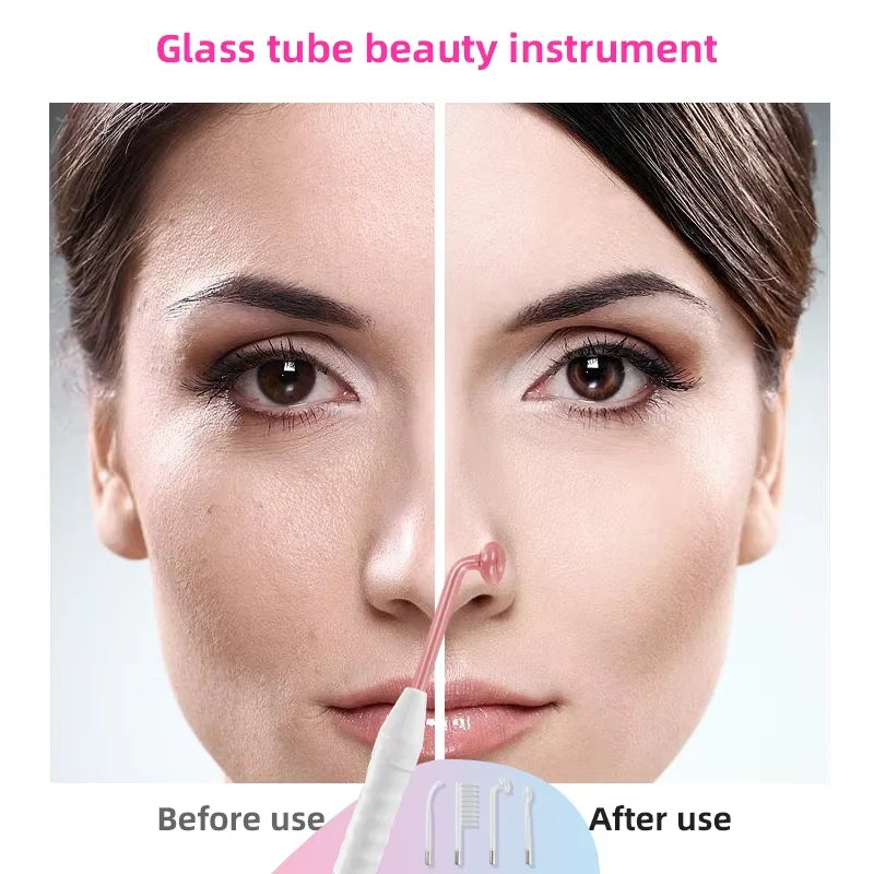 4 – in -1 High Frequency Facial Wand | Glass Electrode Skin Therapy Machine - Lylamor.com