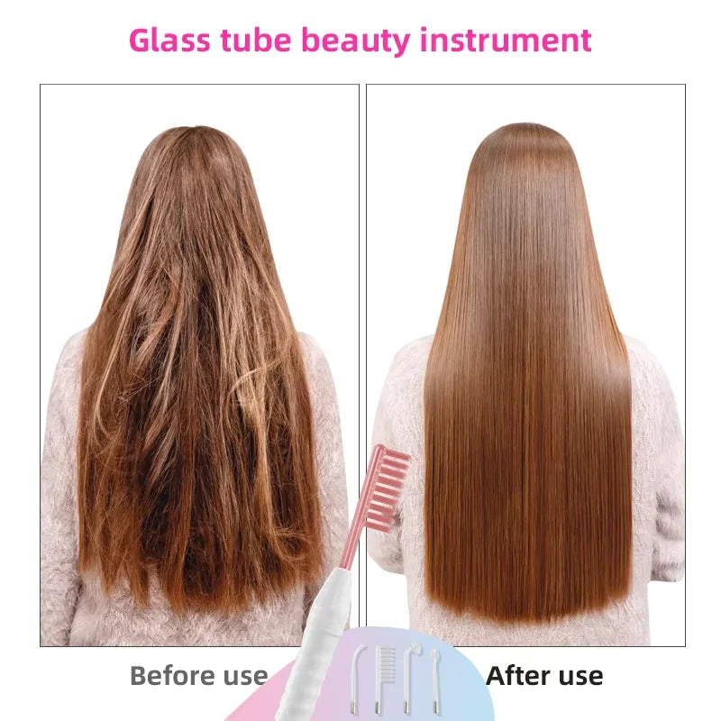 4 – in -1 High Frequency Facial Wand | Glass Electrode Skin Therapy Machine - Lylamor.com