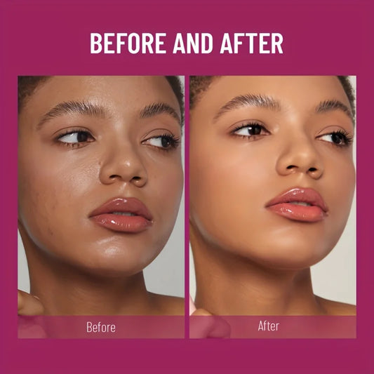 Sponge Head Concealer | Long-Lasting Liquid Foundation for Dark Circles, Acne & Blemishes - Lylamor.com