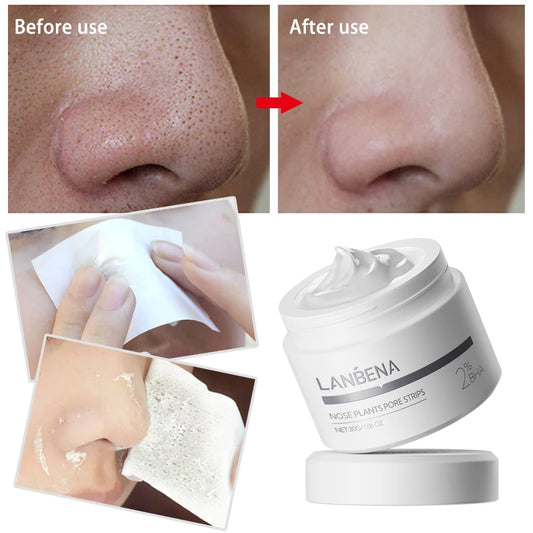 LANBENA Blackhead Remover Nose Mask | Deep Cleansing Pore Strip for Clearer Skin - Lylamor.com